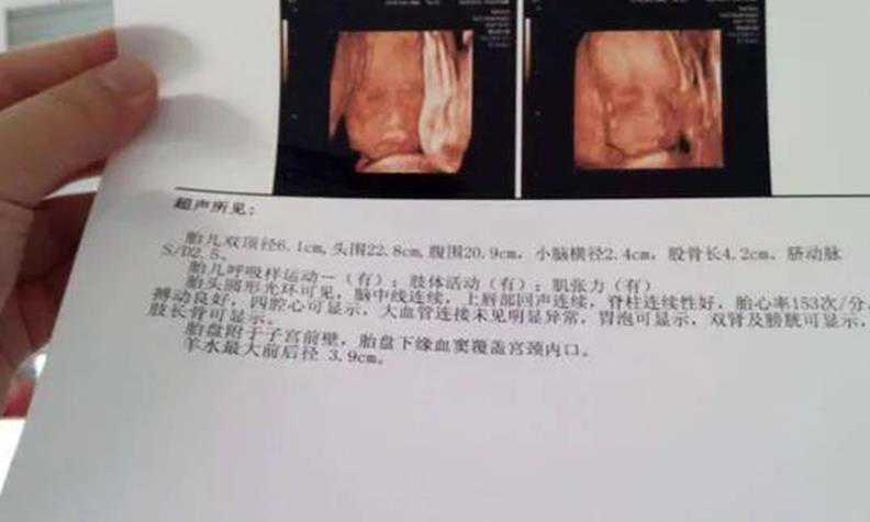民间供卵中心_2023锦州医大三院冷冻精子试管婴儿费用预估，助孕人群必看